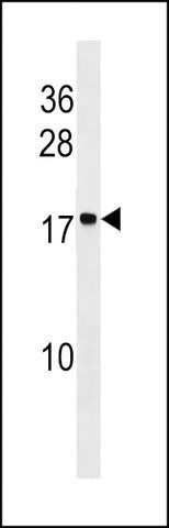 ANTI-STAG3L2 (CENTER) antibody produced in rabbit