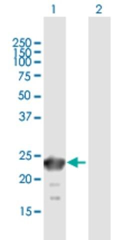 Anti-SSX6 antibody produced in mouse