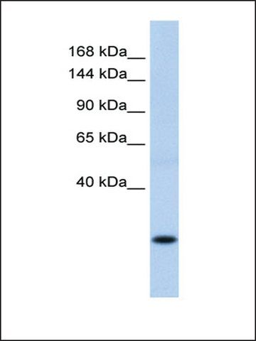 Anti-SSX8 antibody produced in rabbit