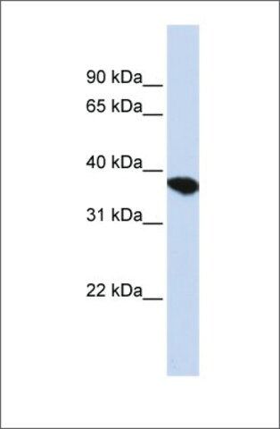 Anti-ST8SIA4