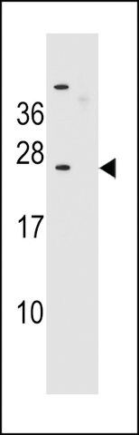 ANTI-SSX6 (CENTER) antibody produced in rabbit