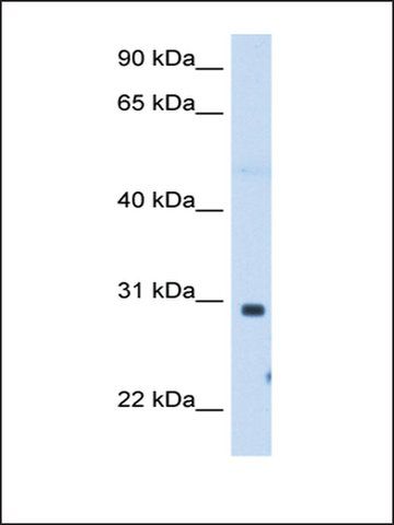 Anti-ST3GAL3 (AB2) antibody produced in rabbit