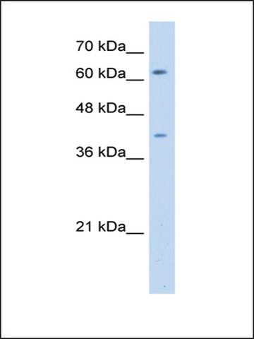 Anti-SWAP70 antibody produced in rabbit