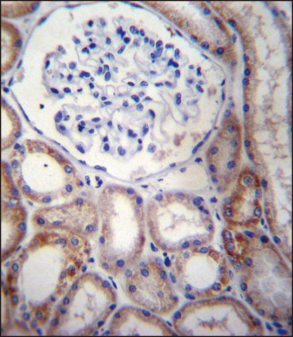 ANTI-STARD5 (N-TERM) antibody produced in rabbit