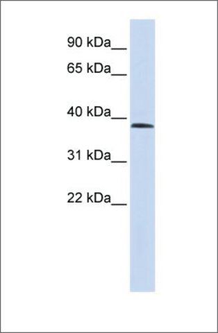 Anti-SUV420H1 (ab2) antibody produced in rabbit