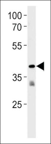 ANTI-TAAR2(N-TERMINAL) antibody produced in rabbit