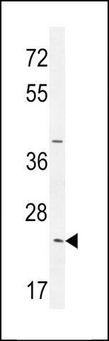 ANTI-SYCE2 (N-TERM) antibody produced in rabbit