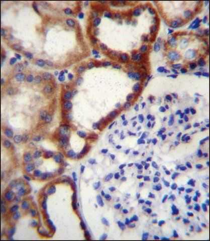 ANTI-STARD4 (N-TERM) antibody produced in rabbit