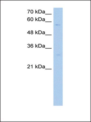 Anti-STEAP4 antibody produced in rabbit