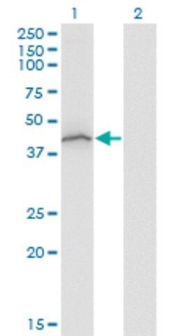 ANTI-STAT5B antibody produced in mouse