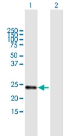 Anti-STARD5 antibody produced in mouse