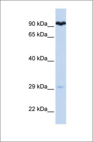 Anti-SUPV3L1 antibody produced in rabbit