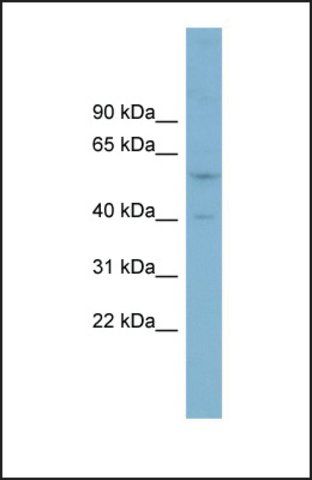 Anti-SUSD4 antibody produced in rabbit