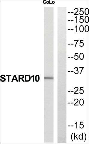 Anti-STARD10 antibody produced in rabbit