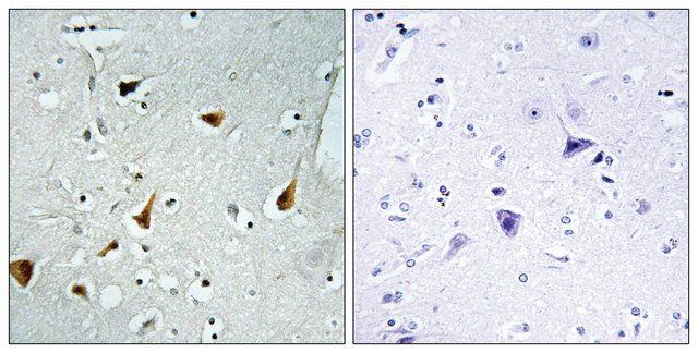 Anti-STAT6 antibody produced in rabbit