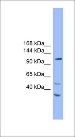 Anti-STARD8 antibody produced in rabbit