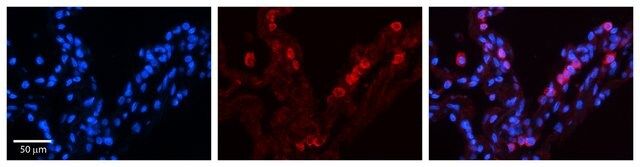 Anti-STAT6 (AB2) antibody produced in rabbit