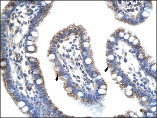 Anti-STAU1 antibody produced in rabbit