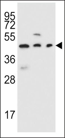 ANTI-STEA2 (CENTER) antibody produced in rabbit