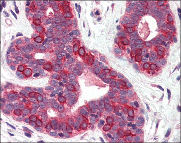 Anti-SURF4 antibody produced in rabbit