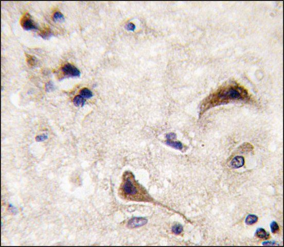 Anti-STEP (N-term) antibody produced in rabbit