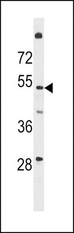 ANTI-T161A(N-TERMINAL) antibody produced in rabbit