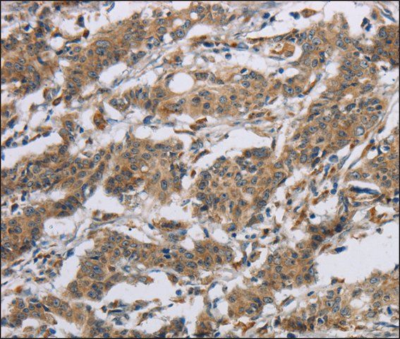 Anti-SYN2 antibody produced in rabbit