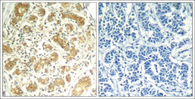 Anti-SYK (Ab-323) antibody produced in rabbit