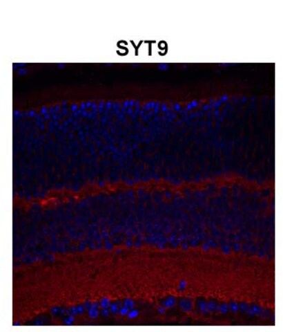 Anti-SYT9 antibody produced in rabbit