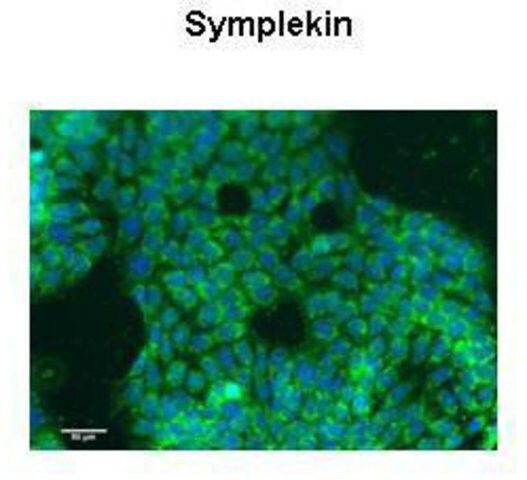 Anti-SYMPK (ab1) antibody produced in rabbit