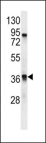 ANTI-TAAR9(C-TERMINAL) antibody produced in rabbit