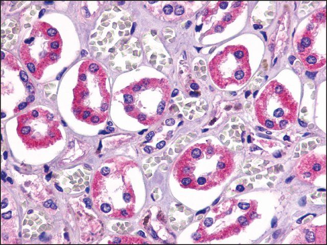 Anti-TAAR6 antibody produced in rabbit