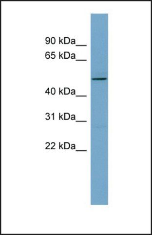 Anti-TCP11 antibody produced in rabbit