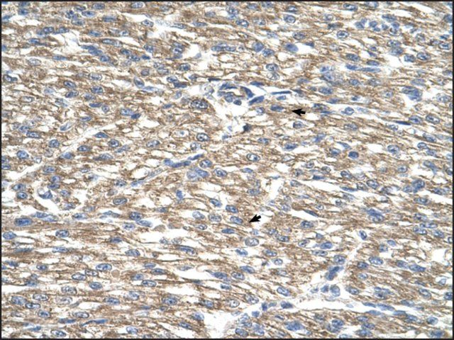 Anti-TCP10L antibody produced in rabbit