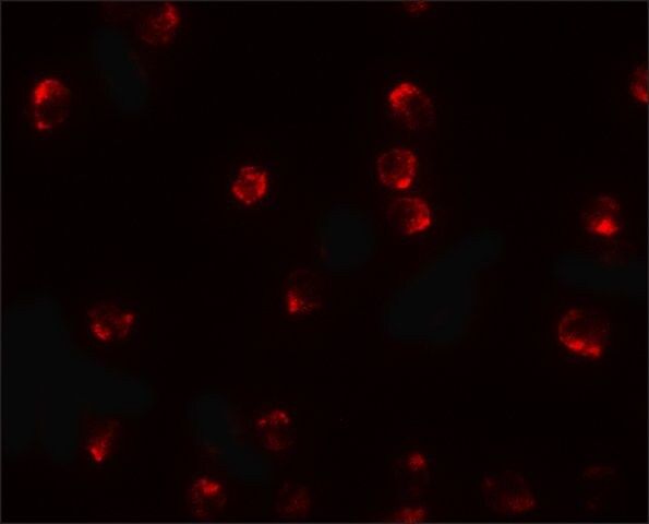 Anti-TCTEX1D2 antibody produced in rabbit