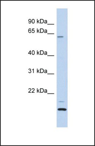 Anti-TCP11L2, (N-terminal) antibody produced in rabbit