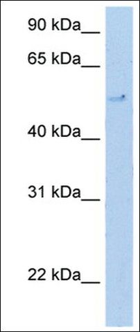 Anti-TERF2 antibody produced in rabbit