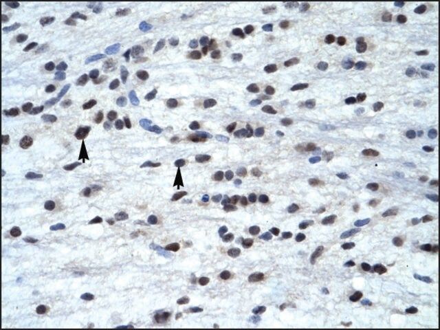 Anti-TFAP4 antibody produced in rabbit