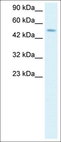 Anti-TFAP2D antibody produced in rabbit