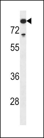 ANTI-TDT(N-TERMINAL) antibody produced in rabbit