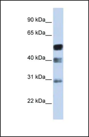 Anti-TFAP2B, (N-terminal) antibody produced in rabbit