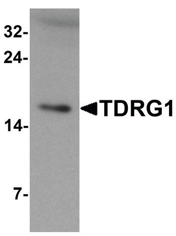 Anti-TDRG1 antibody produced in rabbit