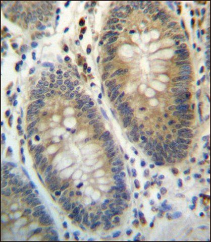 ANTI-TEX261 (C-TERM) antibody produced in rabbit