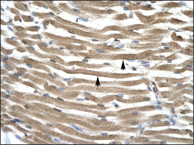 Anti-TFAP4 (AB1) antibody produced in rabbit