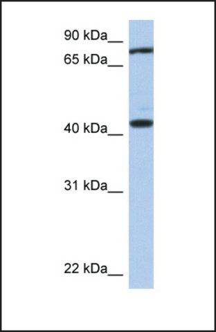 Anti-TEX9 antibody produced in rabbit