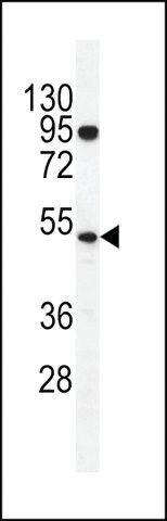 ANTI-TDT(C-TERMINAL) antibody produced in rabbit