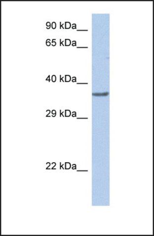 Anti-TFDP1 antibody produced in rabbit