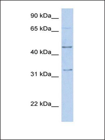 Anti-TFAP2B (AB2) antibody produced in rabbit