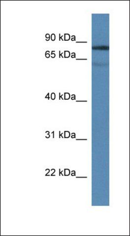 Anti-TDP1 antibody produced in rabbit