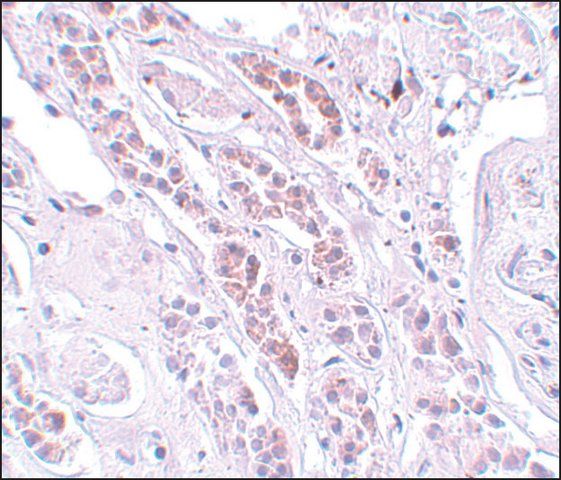 Anti-TCTN1 antibody produced in rabbit